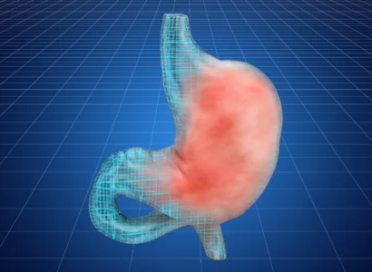 Gastroenterologo – Endoscopista Digestivo